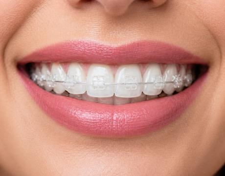 Ортодонтия